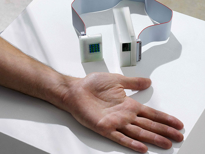 Skan, the hand-held heat sensor used to detect melanoma